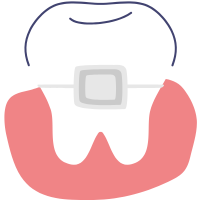 Ceramic braces icon